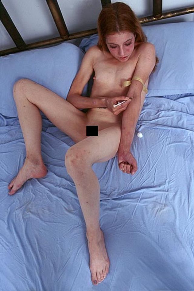 Meth Junkie Porn - Meth Addicted Naked Girls | CLOUDY GIRL PICS
