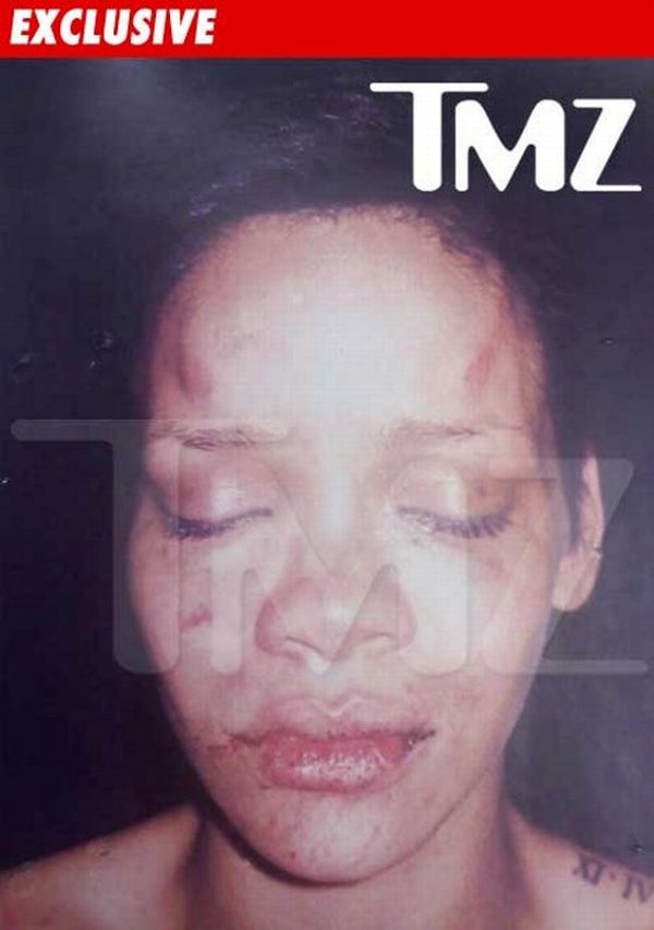 The first picture of beaten Rihanna - 01