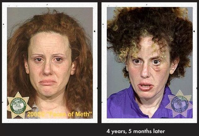 Faces of Meth - 01