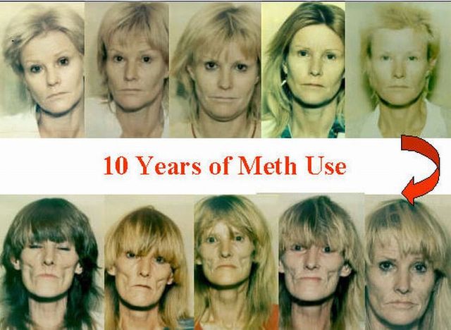 Faces of Meth - 13