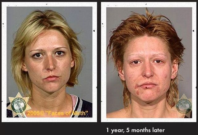 Faces of Meth - 17