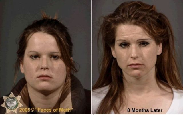 Faces of Meth - 20