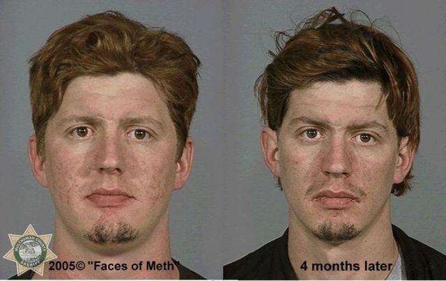 Faces of Meth - 21