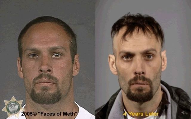 Faces of Meth - 22