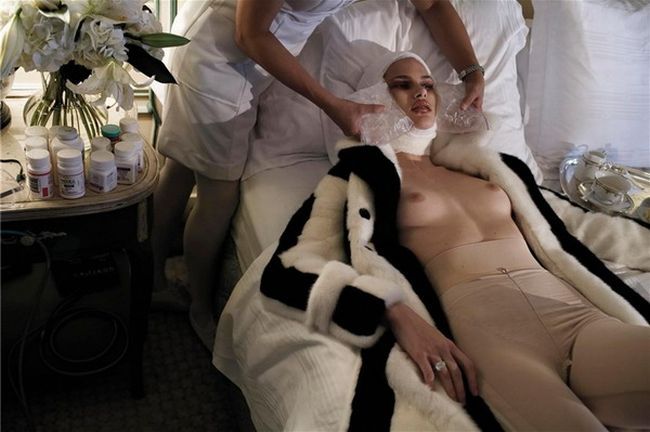 Horrible photo shoot on plastic surgery by famous photographer Steven Meisel - 11