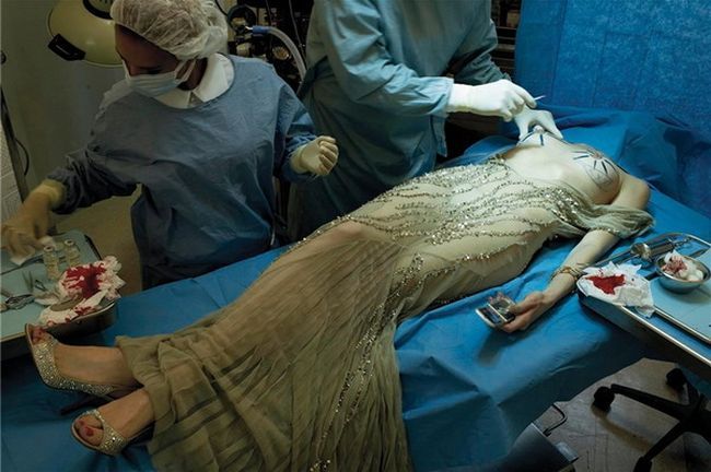 Horrible photo shoot on plastic surgery by famous photographer Steven Meisel - 12