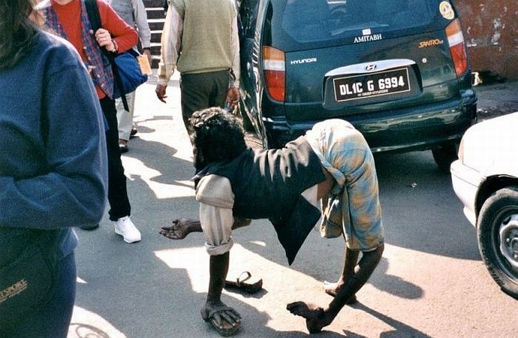 Beggars in India. Not for faint-hearted! - 02