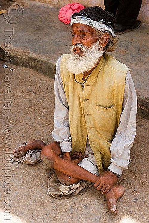 Beggars in India. Not for faint-hearted! - 07