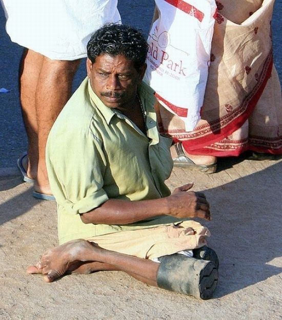Beggars in India. Not for faint-hearted! - 10