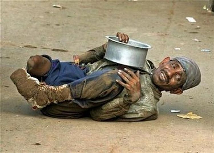 Beggars in India. Not for faint-hearted! - 12