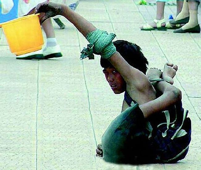 Beggars in India. Not for faint-hearted! - 17