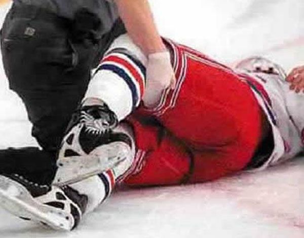 OMG. Horrible sports injuries - 09