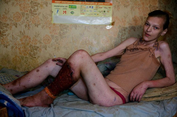 A series of photos by Brent Stirton - Ukraine ... Sex, Drugs, Poverty & HIV. Not for sensitive souls! - 03