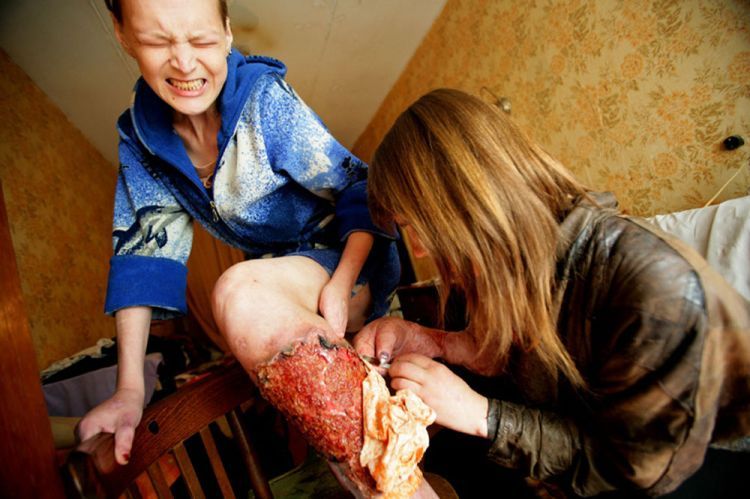 A series of photos by Brent Stirton - Ukraine ... Sex, Drugs, Poverty & HIV. Not for sensitive souls! - 04