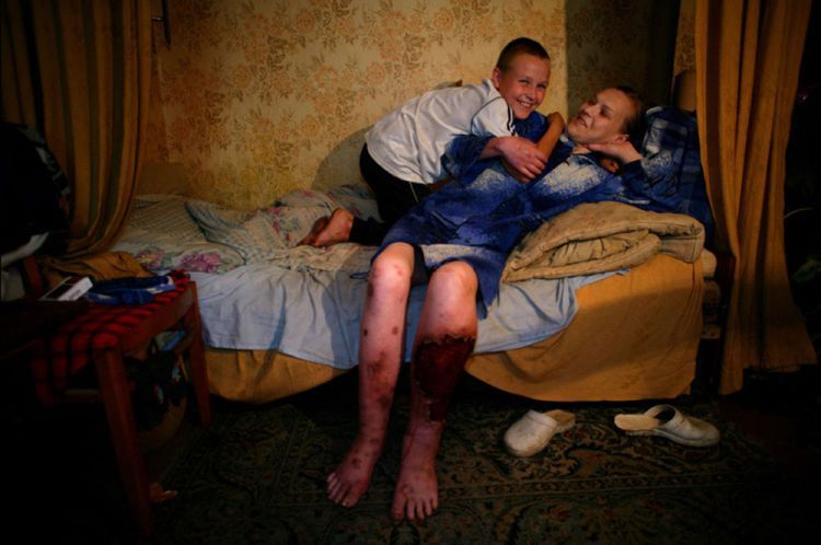 A series of photos by Brent Stirton - Ukraine ... Sex, Drugs, Poverty & HIV. Not for sensitive souls! - 05