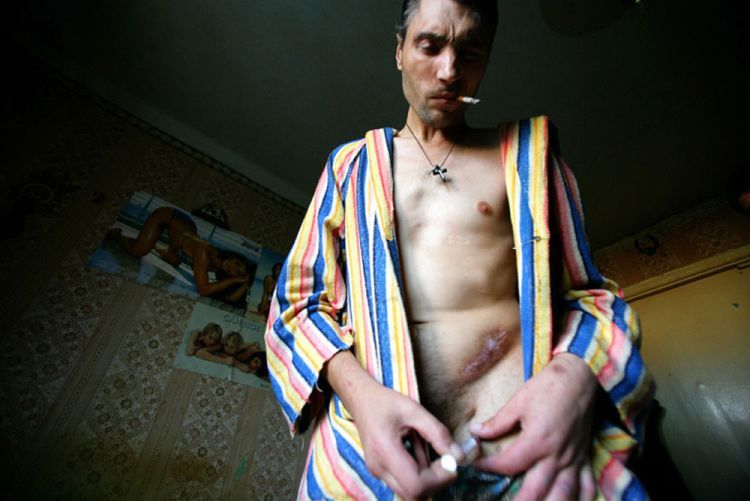 A series of photos by Brent Stirton - Ukraine ... Sex, Drugs, Poverty & HIV. Not for sensitive souls! - 12
