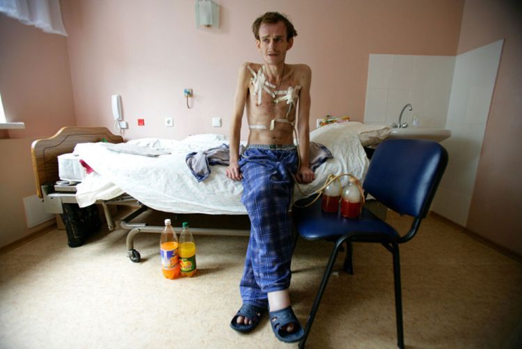 A series of photos by Brent Stirton - Ukraine ... Sex, Drugs, Poverty & HIV. Not for sensitive souls! - 64