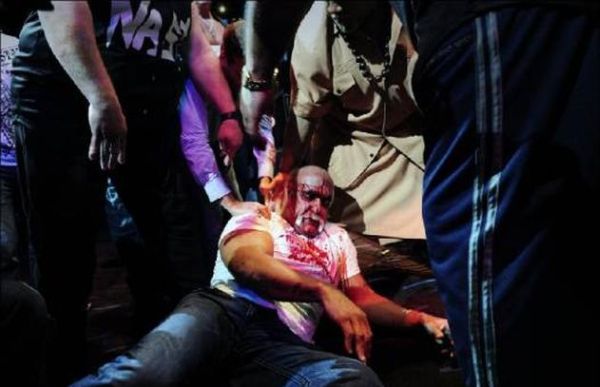 Hulk Hogan got his face smashed at a press conference - 09