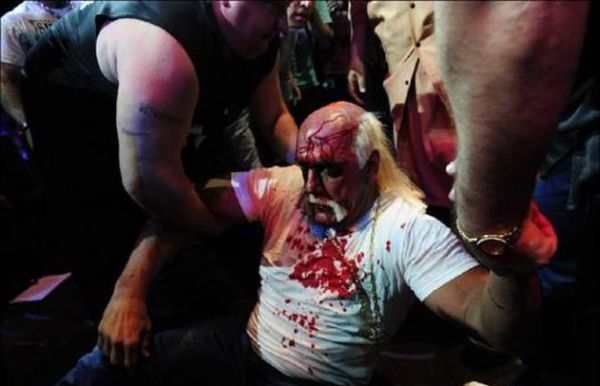 Hulk Hogan got his face smashed at a press conference - 12