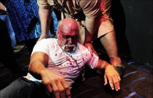 Hulk Hogan got his face smashed at a press conference - 15