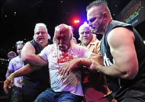 Hulk Hogan got his face smashed at a press conference - 17