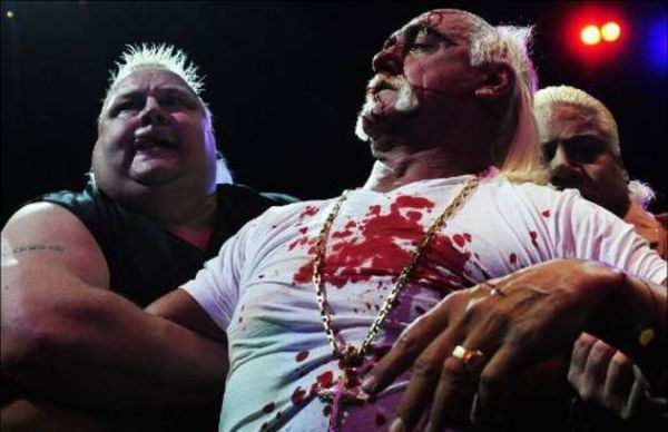 Hulk Hogan got his face smashed at a press conference - 18