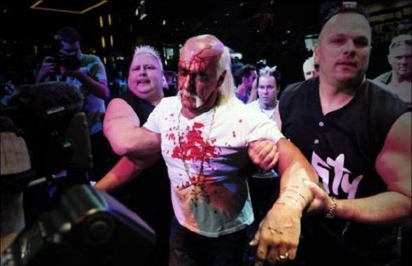 Hulk Hogan got his face smashed at a press conference - 19