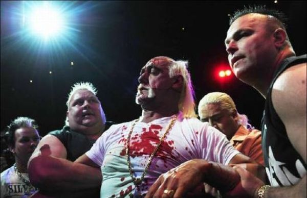 Hulk Hogan got his face smashed at a press conference - 20