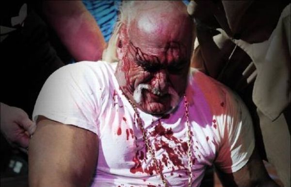 Hulk Hogan got his face smashed at a press conference - 21