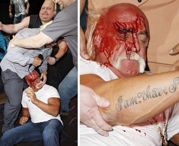 Hulk Hogan got his face smashed at a press conference - 22