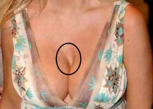 Silicone tits - this is not always good! - 13