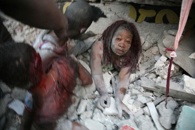 OMG of the day. Terrible consequences of earthquake in Haiti. Viewer discretion is advised! - 01