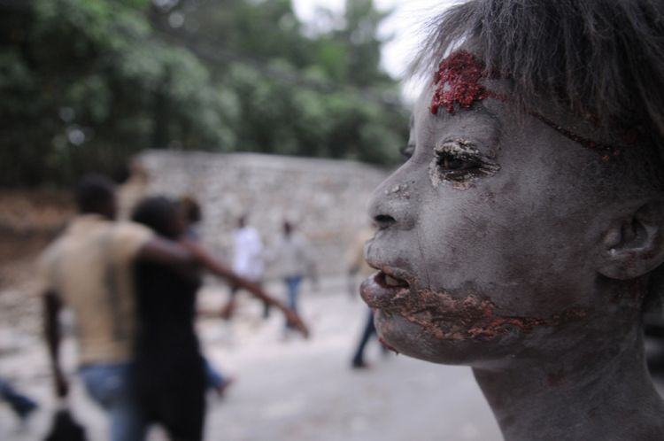OMG of the day. Terrible consequences of earthquake in Haiti. Viewer discretion is advised! - 32
