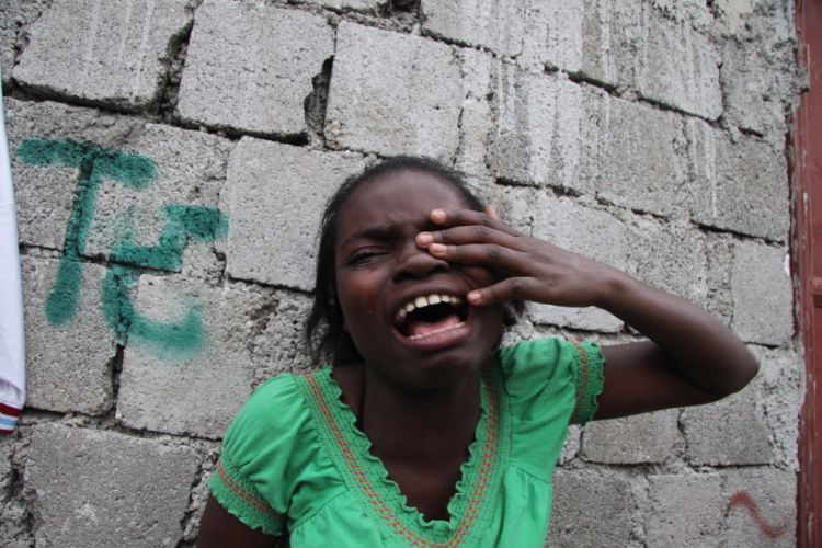 OMG of the day. Terrible consequences of earthquake in Haiti. Viewer discretion is advised! - 38
