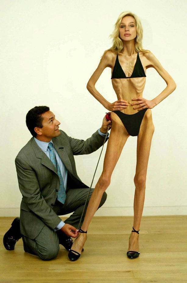 Selection of anorexic girls. And how someone can like it? - 53