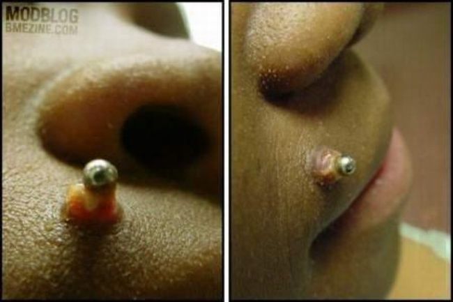 What causes bad piercing. Not for sensitive souls! - 04