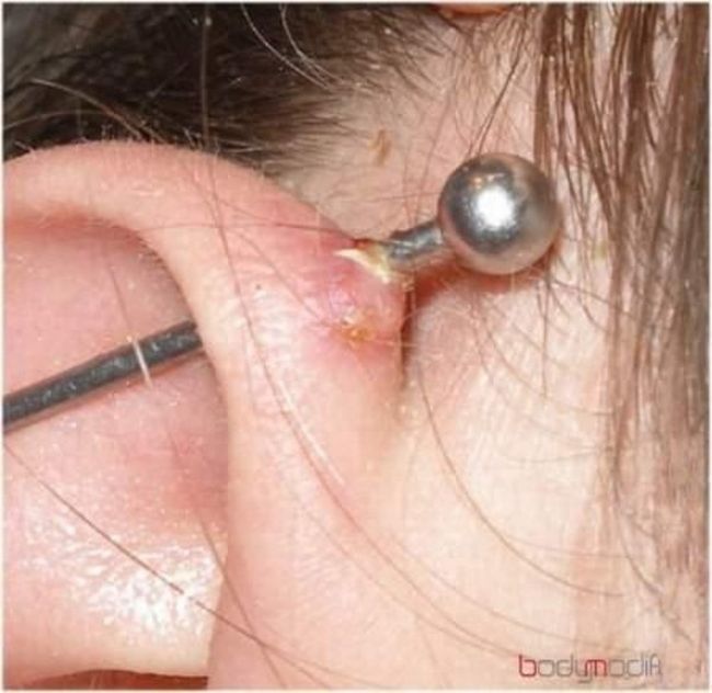 What causes bad piercing. Not for sensitive souls! - 05