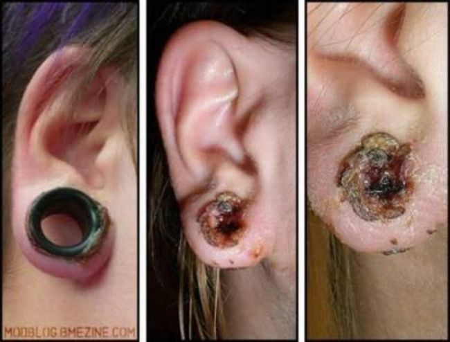 What causes bad piercing. Not for sensitive souls! - 07