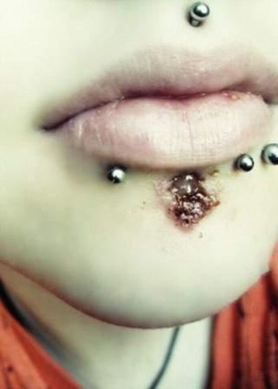 What causes bad piercing. Not for sensitive souls! - 10