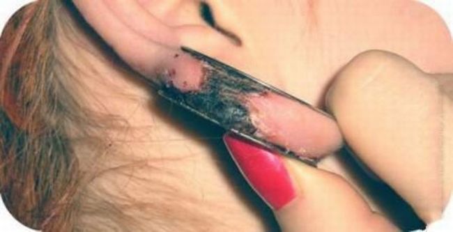 What causes bad piercing. Not for sensitive souls! - 13