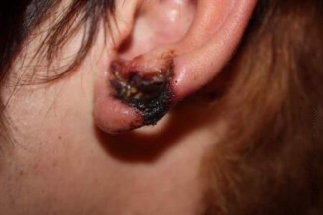 What causes bad piercing. Not for sensitive souls! - 14
