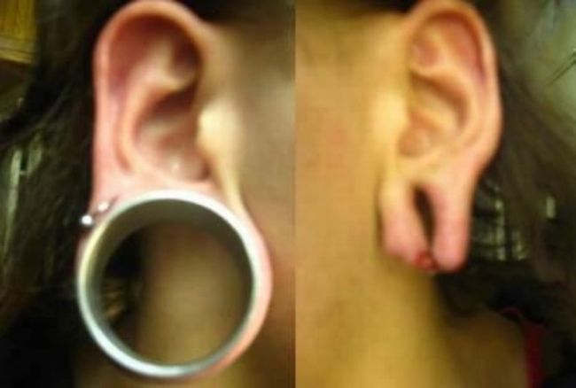 What causes bad piercing. Not for sensitive souls! - 15