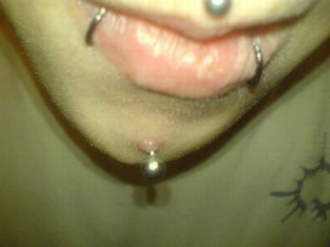 What causes bad piercing. Not for sensitive souls! - 18