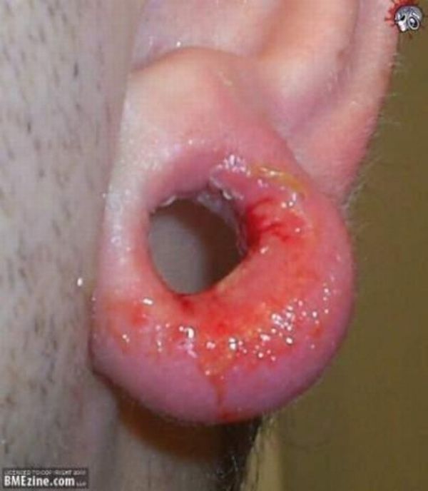 What causes bad piercing. Not for sensitive souls! - 21