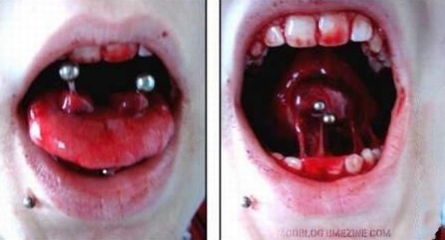 What causes bad piercing. Not for sensitive souls! - 22