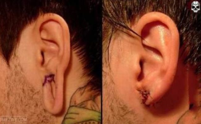 What causes bad piercing. Not for sensitive souls! - 24