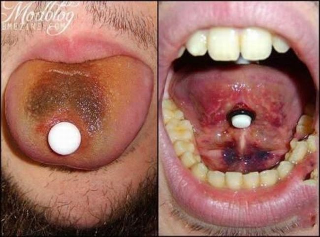 What causes bad piercing. Not for sensitive souls! - 26