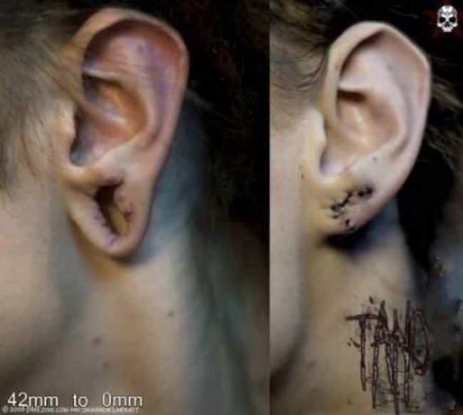 What causes bad piercing. Not for sensitive souls! - 29