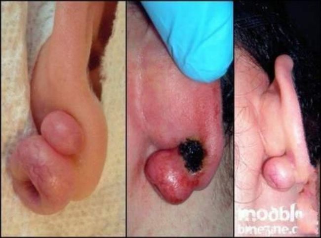 What causes bad piercing. Not for sensitive souls! - 32