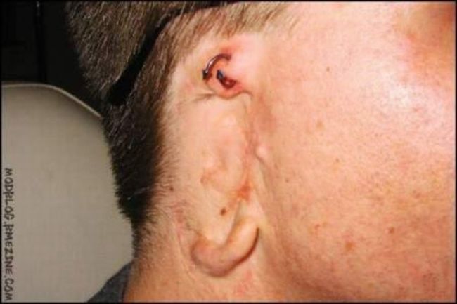 What causes bad piercing. Not for sensitive souls! - 39